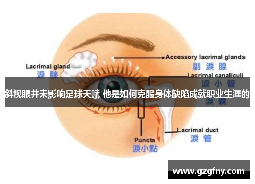 斜视眼并未影响足球天赋 他是如何克服身体缺陷成就职业生涯的